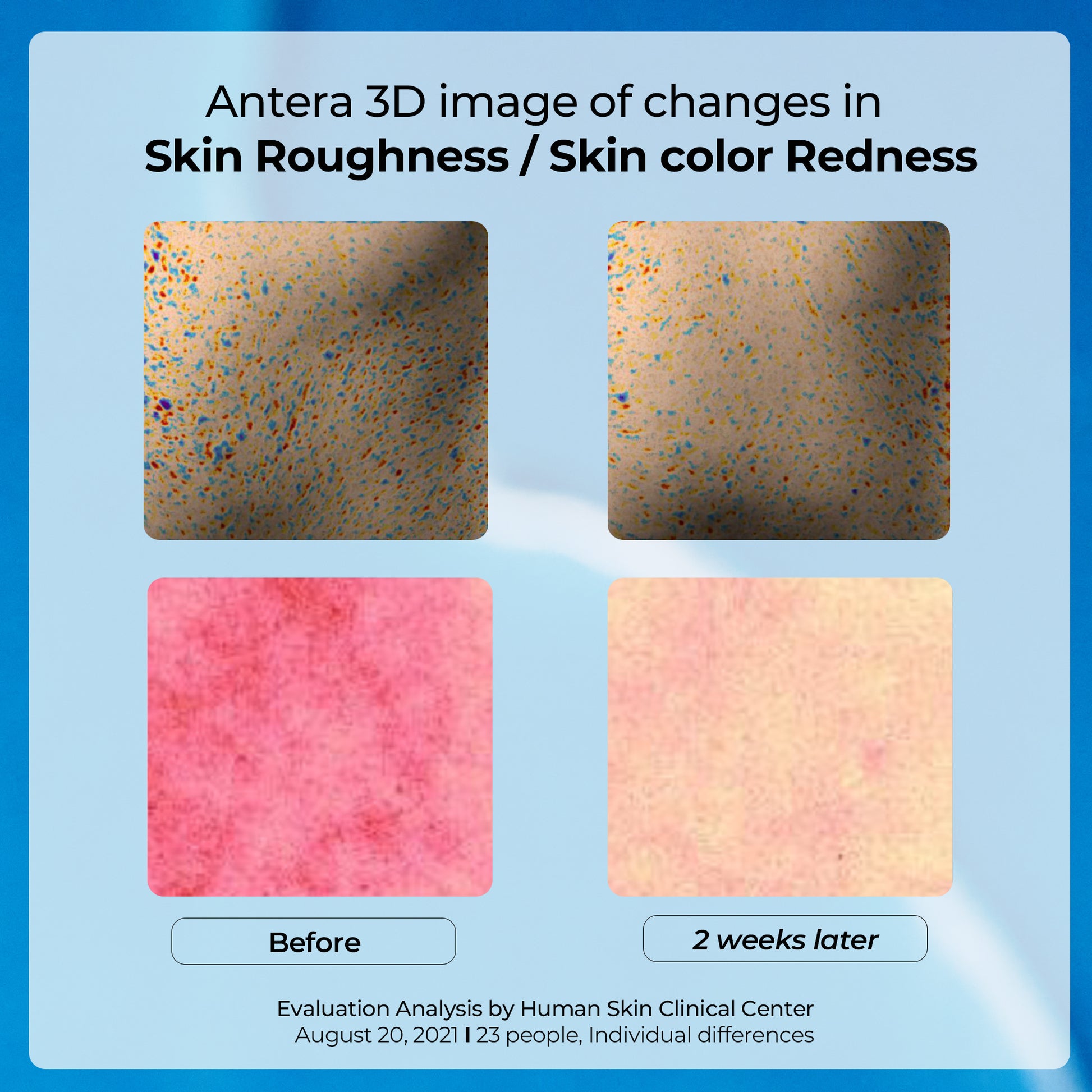 Hydra Barrier Cica Essence Toner (EXP. 07/2026)